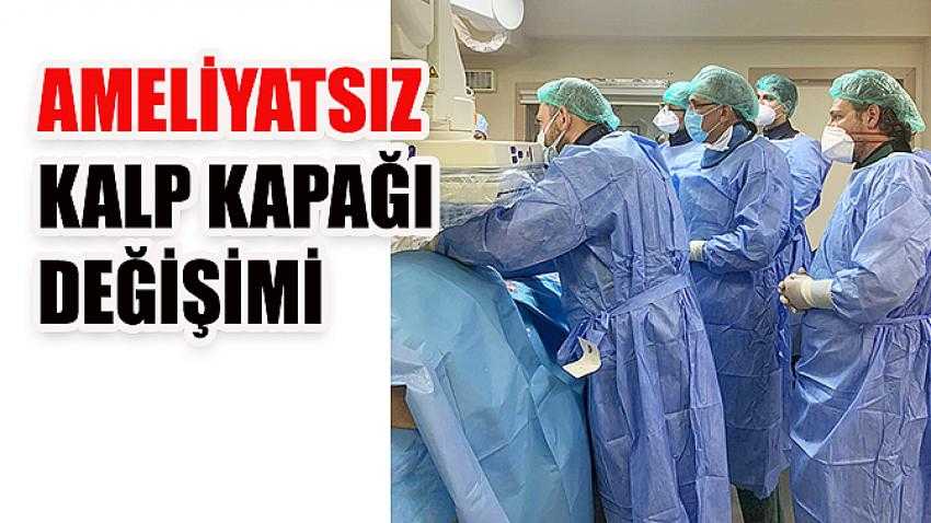 Ameliyatsız Kalp Kapağı Değişimi